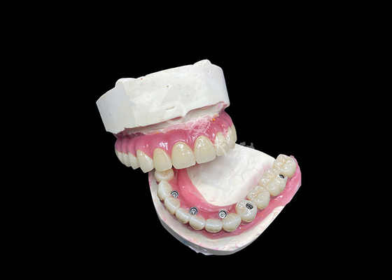 Buy Zirconia Dental Implant Crown Bridge All On 6 For Missing Teeth Replacement online manufacture