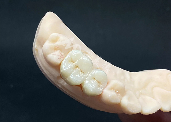 Buy High Translucency Zirconia Crown Natural Looking Design with Chipping Resistance online manufacture