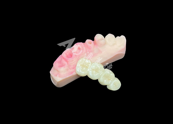 Buy Superior Solid Zirconia Crown Bridge For Natural-Looking Dental Aesthetics online manufacture