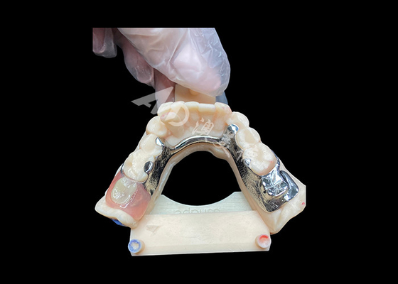 Buy Easy Maintenance Cast Partial Dentures for Superior Strength and Aesthetic Appeal online manufacture