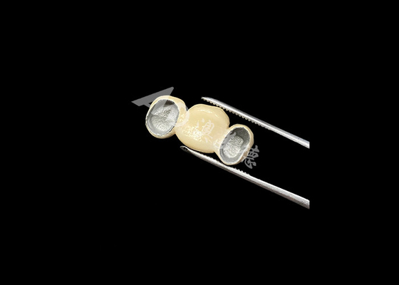 Buy Precise Fit Porcelain Fused To Metal Crown With Excellent Biocompatibility online manufacture