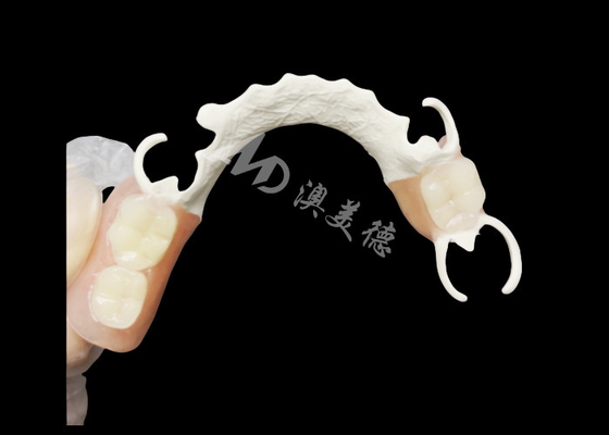 Buy Custom Cast Partial Denture with HPP framework for Enhanced Chewing and Speech online manufacture