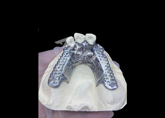 Buy Easy Fit Custom Cast Partial Denture Stable and Natural-looking Framework for Fast Results online manufacture