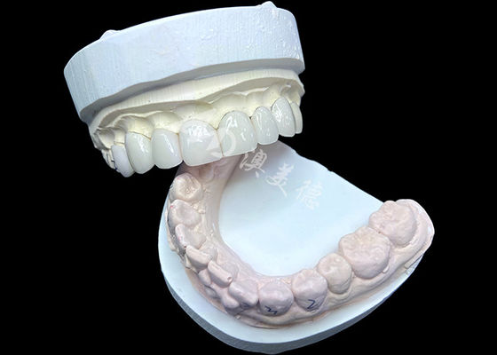 buy IPS e.max Veneers in Shade BL2 Achieve Stunning Natural Aesthetics online manufacture