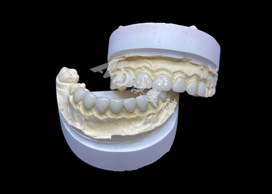 buy Customization Ultra Thin Glass Ceramic Veneers High Translucency online manufacture