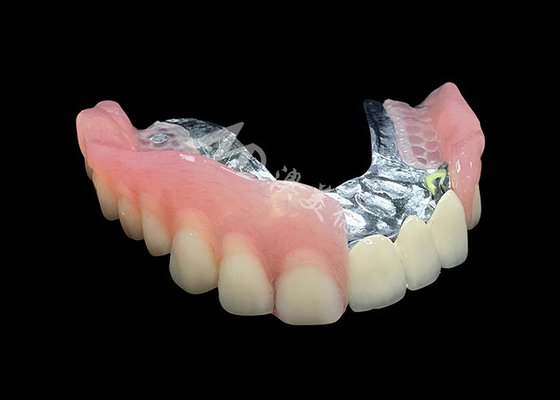 Buy Enhance Your Smile Natural-looking PFM Crown bridge and Removable Dentures Combo online manufacture