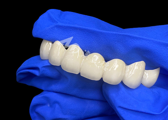 Buy High Translucency Lava Zirconia Dental Bridge Seamless Blend With Natural Teeth online manufacture