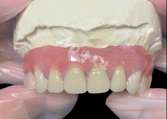 Buy Titanium implant supported Bar Attachment Dentures from china dental lab online manufacture