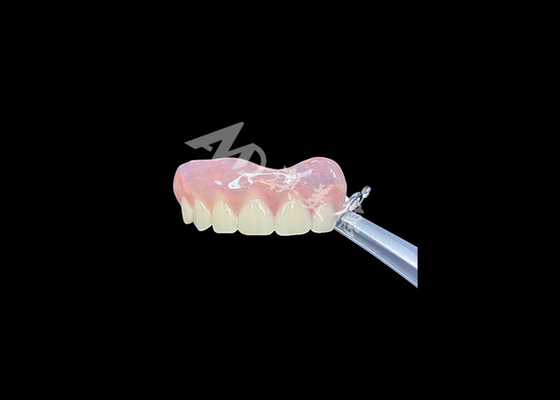 Buy Easy Fit Cast Partial Denture Restores Chewing And Speaking Ability online manufacture