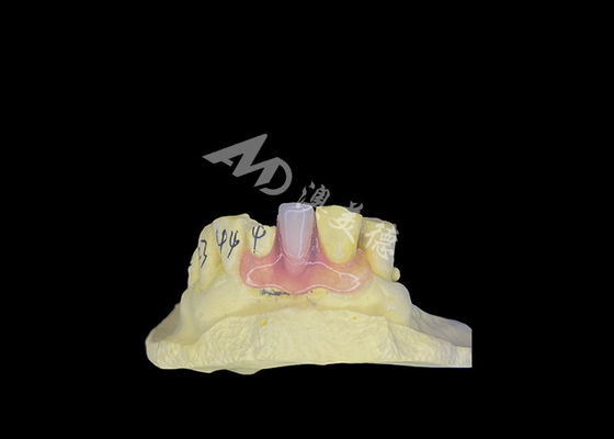Buy Nesbit Flexible Partial Denture for Comfort and Durability in Tooth Replacement online manufacture