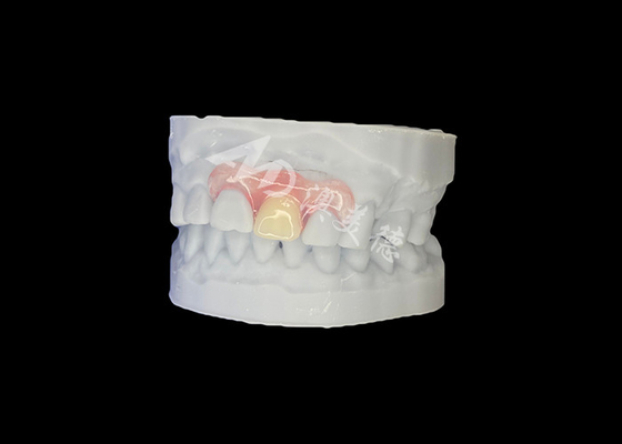 Buy Customized Nesbit Flexible Partial Denture for Natural Fit and Longlasting Comfort online manufacture