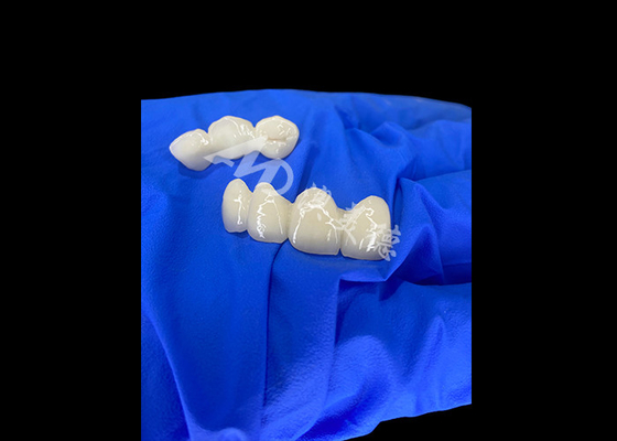 Buy Wieland Zenostar Ceramic Crown Bridge High Precision for Durable and Natural Looking Restorations online manufacture