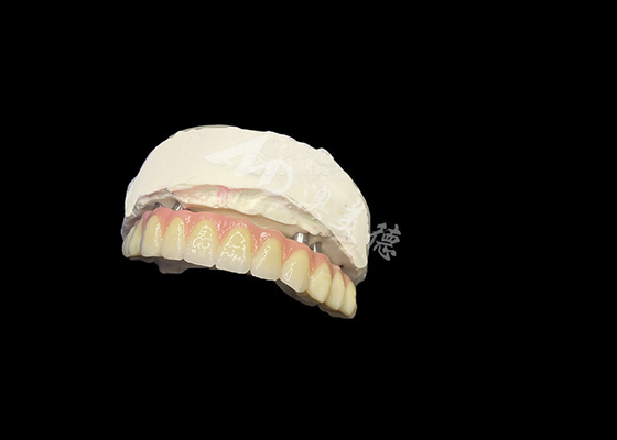 Buy Implant Supported Dentures Stability Comfort and a Natural Smile online manufacture