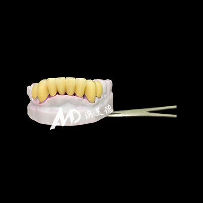 Buy Durable Zirconia Dental Crown with Metal Post Core for Strong, Natural-Looking Tooth Restoration online manufacture