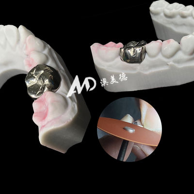 Buy Metal Titanium Crown Precision Strength and Biocompatibility for Lasting Restorations online manufacture