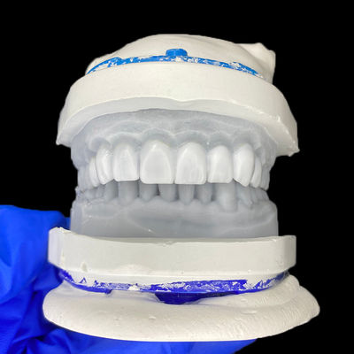 buy Diagnostic Wax-Up for Porcelain Veneers online manufacture