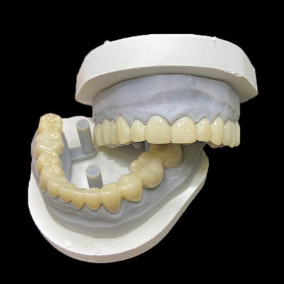 Buy PMMA Temporary Restorations CAD/CAM PMMA Crowns and Bridges for Provisional Dental Cases online manufacture