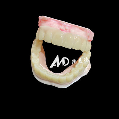 Buy Lightweight PMMA Temporary Bridges with Hollow Design for Implant Restorations online manufacture