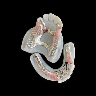 Buy Custom Metal Framework Partial Denture with Invisible Clasps for Precision Fit and Superior Esthetics online manufacture