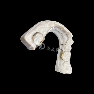 Buy Custom Lingual Arch with Bands Orthodontic Appliance for Space Maintenance and Dental Alignment online manufacture