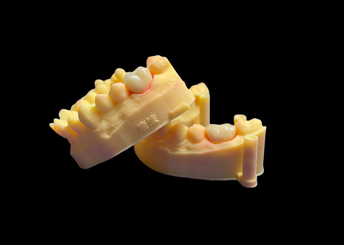 Premium Zirconia Porcelain Dental Crown Unmatched Strength Precision Fit and Exceptional Aesthetics and Durability