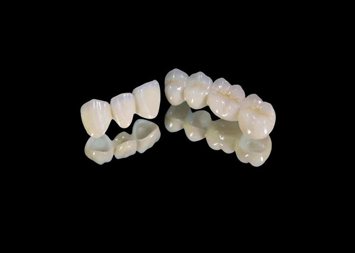 Wear-Resistant Zirconia Dental Crown with Chip and Stain Resistance and Natural Aesthetics from China dental lab