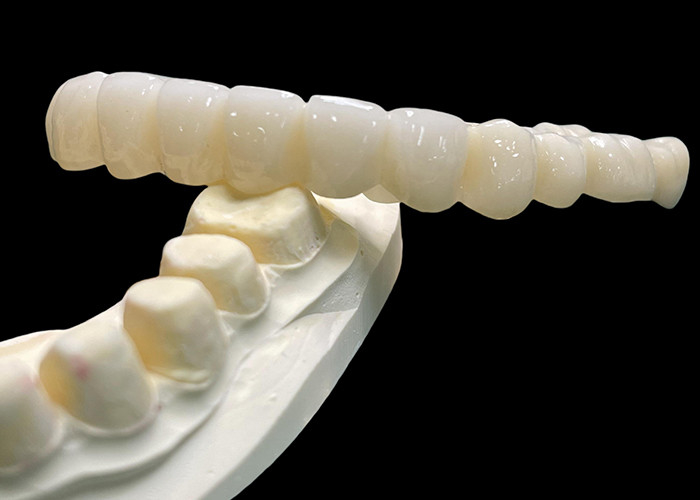 Vita Classical Shade All Ceramic Crown Bridge Natural Looking For Dental Restoration