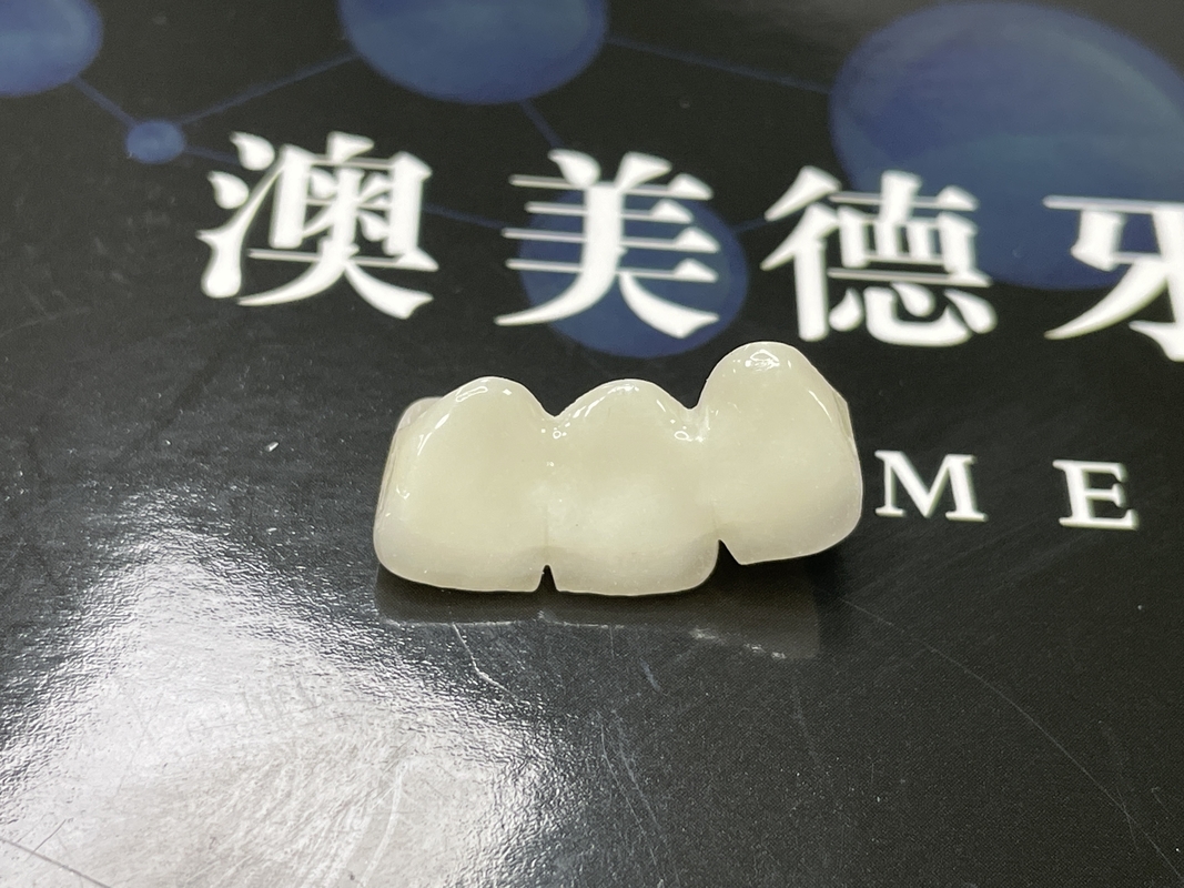 Natural Aesthetics Translucent Ceramic Crowns for Dental Restoration with Easy Cleaning and Long-Lasting Results