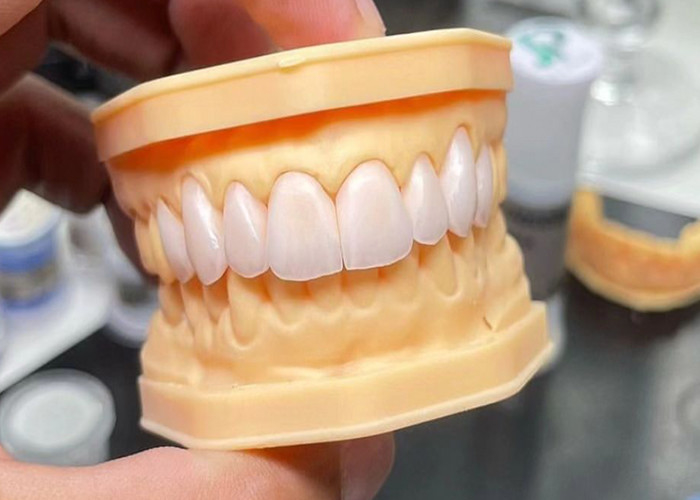 High Strength Full Ceramic Crown Bridge with Exceptional Biocompatibility for Long-Lasting Durability
