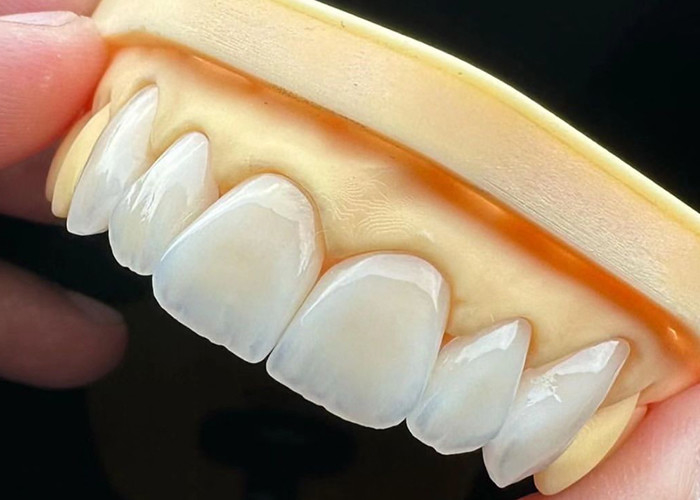 High Strength Full Ceramic Crown Bridge with Exceptional Biocompatibility for Long-Lasting Durability