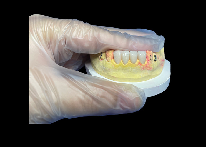 Strength Wear Resistant Ceramic crown Bridge for Comfortable Precise Dental Restoration