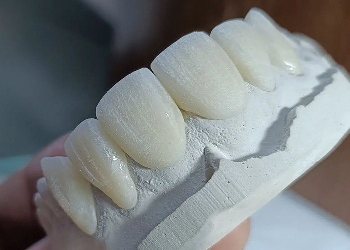 Strength Wear Resistant Ceramic crown Bridge for Comfortable Precise Dental Restoration
