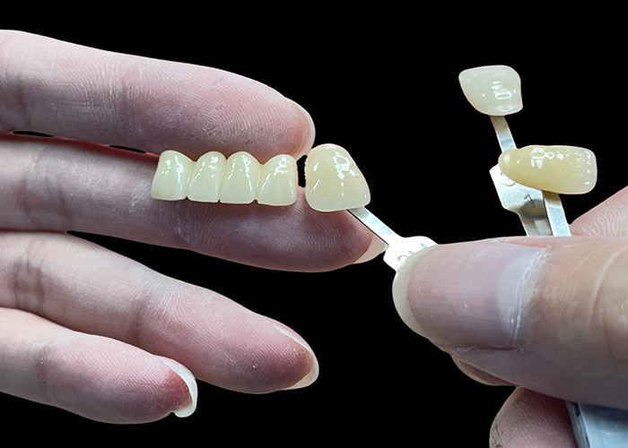 Stain Resistant All Porcelain Bridge Comfortable Fit For Dental Restoration