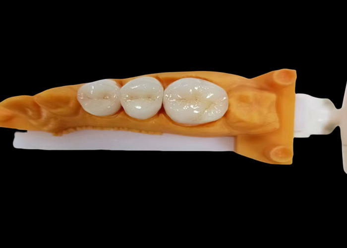 Wear-Resistant Zirconia Dental Crown with Chip and Stain Resistance and Natural Aesthetics from China dental lab