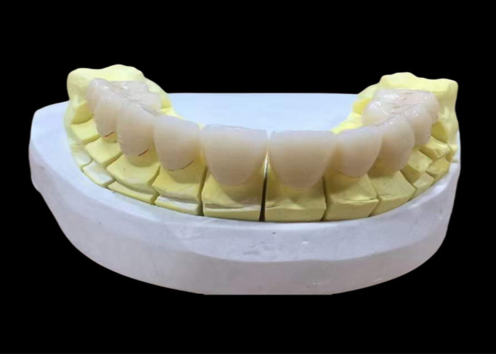 Zirconia porcelain Dental Crown with Aesthetic and Natural-Looking Finish from China dental lab