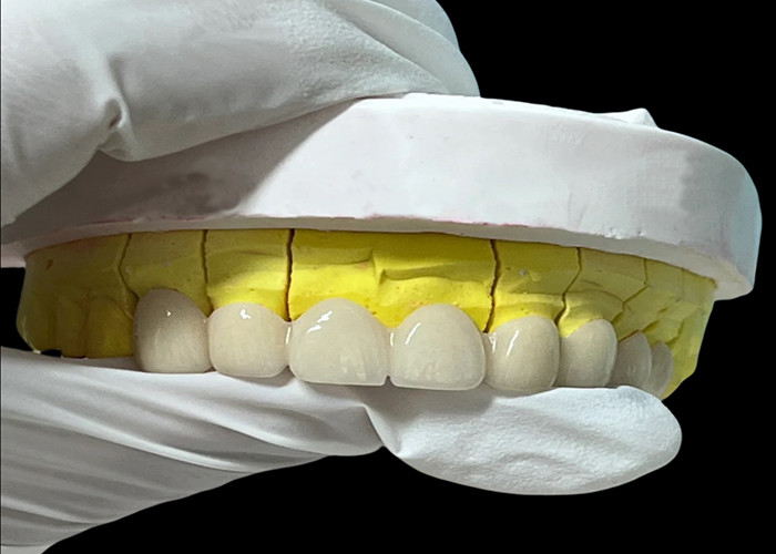 Zirconia porcelain Dental Crown with Aesthetic and Natural-Looking Finish from China dental lab