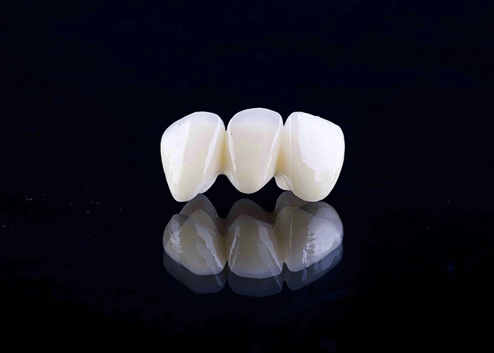 Zirconia porcelain Dental Crown with Aesthetic and Natural-Looking Finish from China dental lab