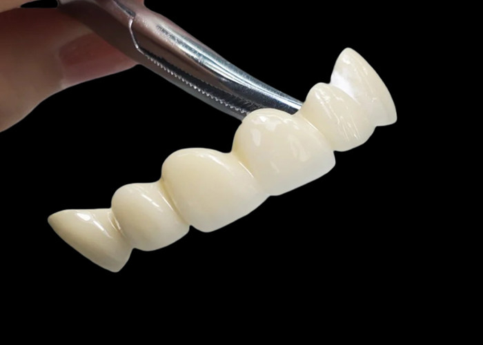 Custom Translucent Zirconia Dental Crown With High Durability Stain Resistant from China dental lab