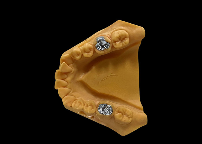 Porcelain Fused To Metal PFM Crown Dental Wear Resistance For Restorative Dentistry