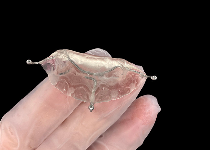 Custom Made Orthodontic Appliances bite plane for  correct bite issues or in TMJ relieve pressure on the jaw joint.