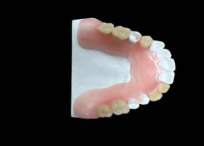 Full Acrylic Dentures Lightweight Durable Affordable and Customizable Solution for Complete Tooth Replacement