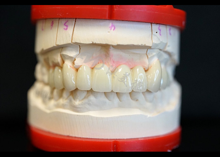 Strength Natural Esthetics Solid Zirconia Crown Perfect Fit for Single or Multiple Teeth
