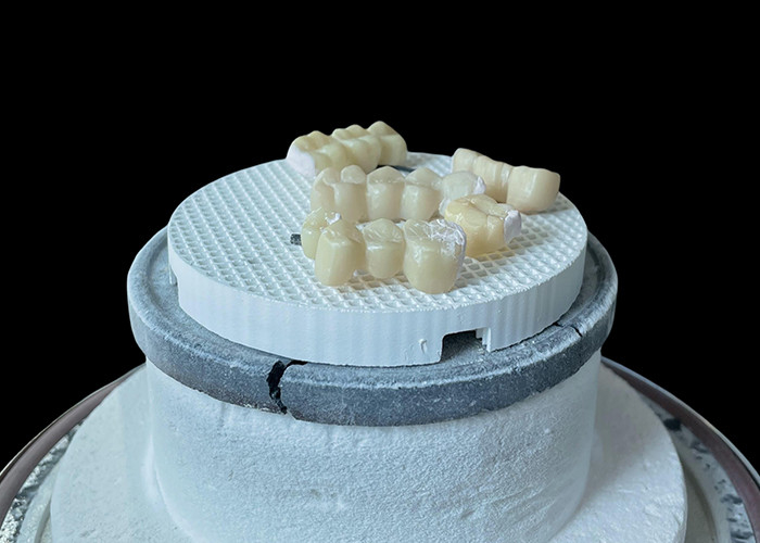 Comfortable Porcelain Dental Bridge with All-Ceramic Construction for Exceptional Wear Resistance