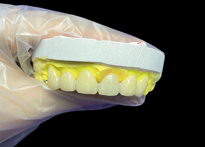 Cosmetic Vita Classical Shade Ceramic Crowns and Bridges with Precise Fit Natural Look and Customizable Options