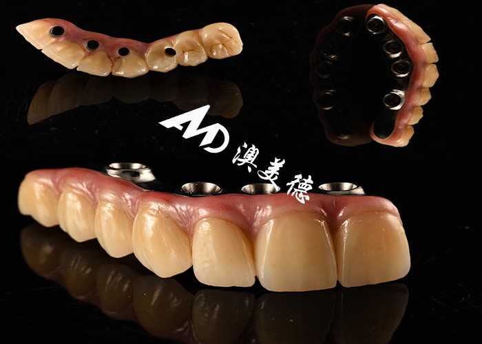 Natural Looking Dental Implant Crown bridge Fixed with Titanium abutment for Missing Teeth Surgery