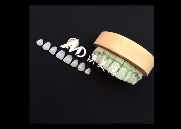 Transform Your Smile with IPS emax Press Porcelain Veneers Strength Aesthetics and Durability Combined