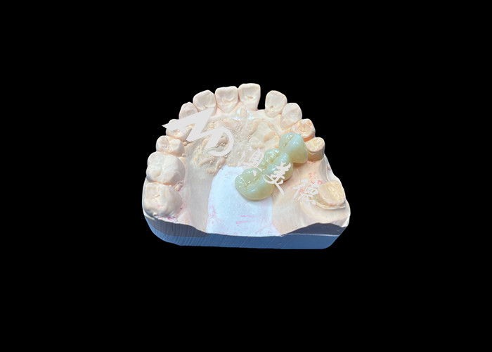 Natural Color Zirconia Dental Crown Crack Resistant For A Flawless Smile from China Dental Lab