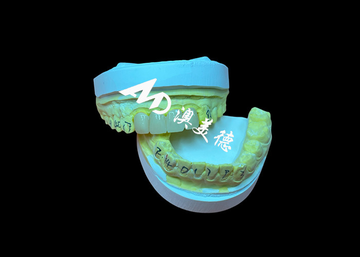 Dental Restoration Translucent Zirconia Dental Crown For Precise Fit And Natural Aesthetics