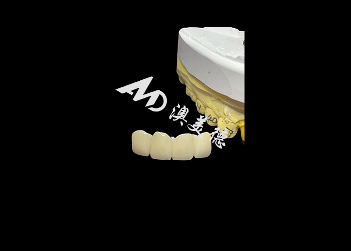 Dental Restoration Translucent Zirconia Dental Crown For Precise Fit And Natural Aesthetics
