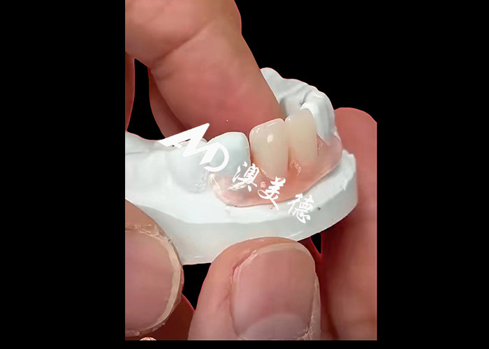 Nesbite flexible dentures offer a seamless solution for a comfortable and natural-looking smile